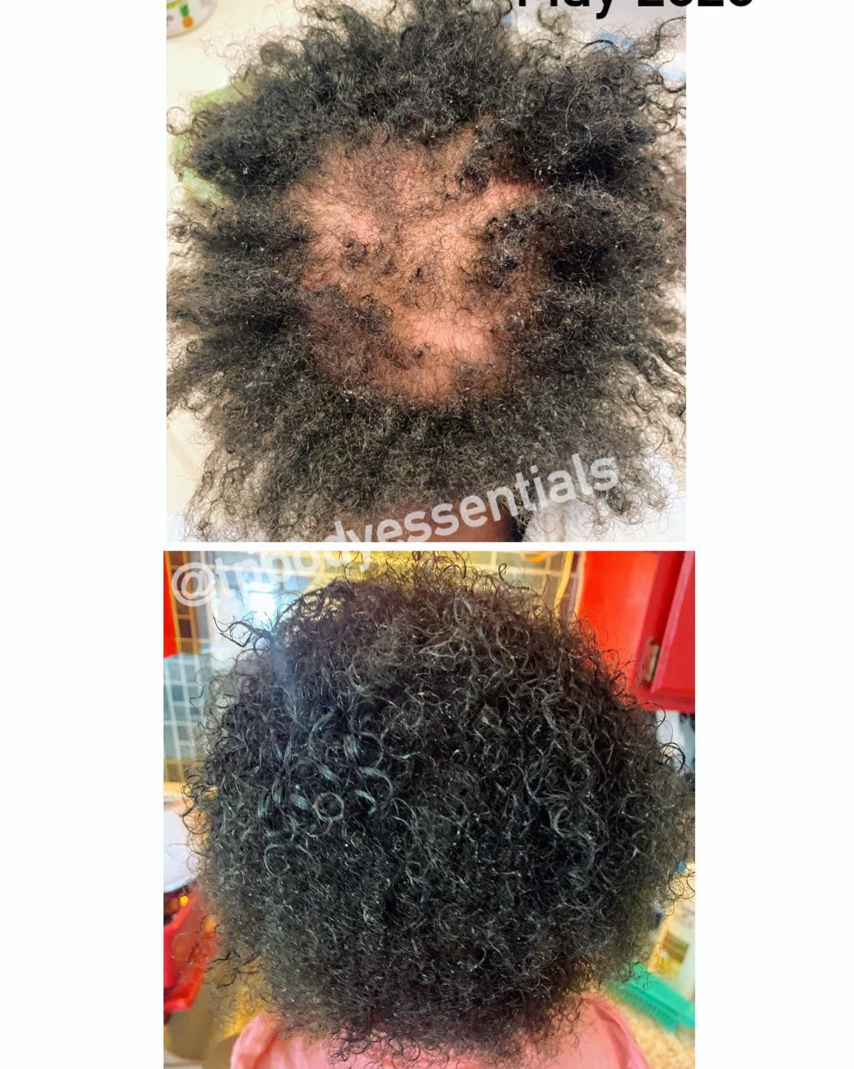 Herbal Hair Growth Serum