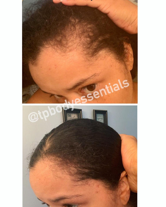 Herbal Hair Growth Serum