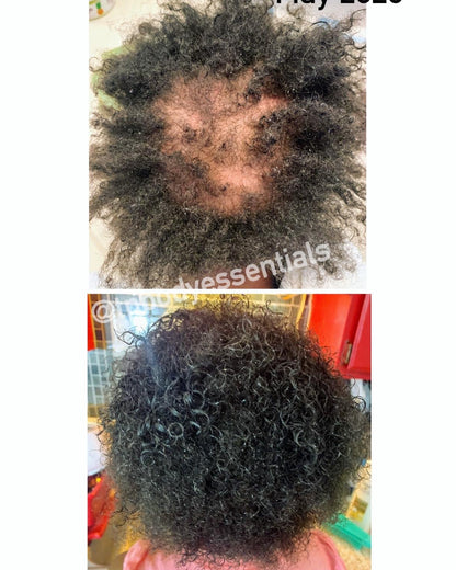Herbal Hair Growth Serum